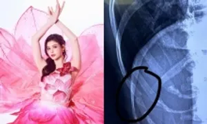 Trương Quỳnh Anh: 'Tôi liều khi bị gãy xương sườn vẫn nhảy' Trương Quỳnh Anh: 'Tôi liều khi bị gãy xương sườn vẫn nhảy'