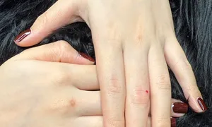 Rủi ro khi xăm nốt ruồi son 'đổi vận' năm mới Rủi ro khi xăm nốt ruồi son 'đổi vận' năm mới