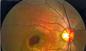 Ánh đèn laser trên sân khấu chiếu thủng mắt chàng trai