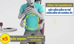Cách sơ cứu người hóc dị vật Cách sơ cứu người hóc dị vật